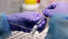 تسجيل 826 إصابة جديدة مؤكدة بكورونا خلال 24 ساعة بالمغرب