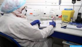 دراسة مغربية تظهر أن كشف الأجسام المضادة في عينات المصل أهم من الكشف عن الحمض النووي الريبي للفيروس