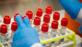 حالة إستنفار بأكادير و الدشيرة الجهادية بعد تسجيل حالتين جديدتين بمركز النداء