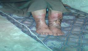 تدخل جمعيات المجتمع المدني يُنقذ حياة مسن، وأسرة المريض تُناشد القلوب الرحيمة.