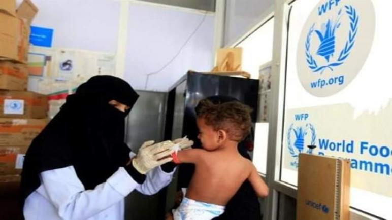 منظمات أممية تحذر من أن نصف أطفال اليمن سيعانون من سوء التغذية خلال 2021