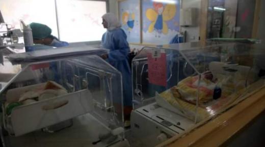 الرباط.. الحالة الصحية للتوأم السيامي “جيدة” بعد عملية فصلهما