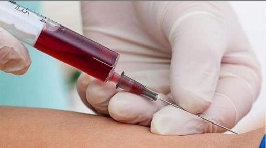 تحليل دم يكشف عن أكثر من 50 نوعا من السرطان