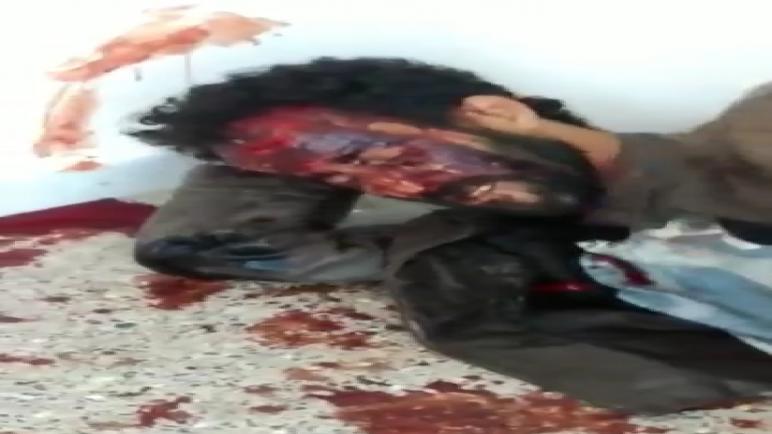 مسؤول بجماعة تيدزي إحاحان بإقليم الصويرة يعتدي على مواطن بالضرب والجرح.