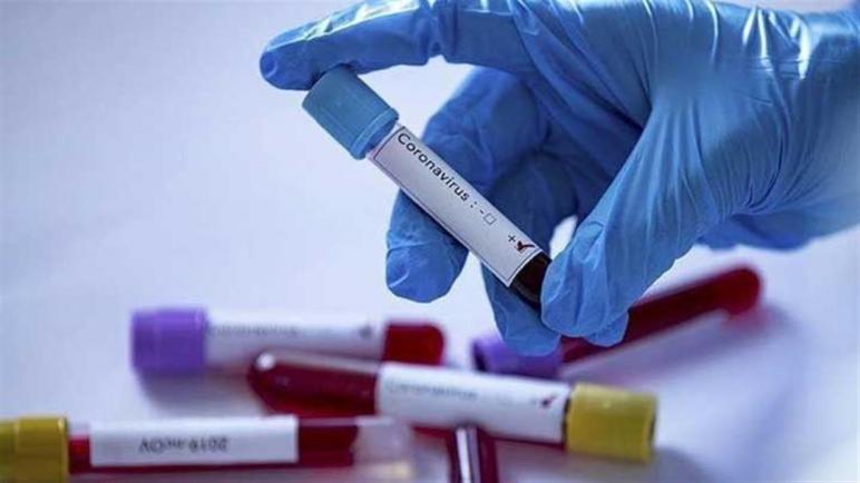 فيروس كورونا يتسلل للجسم الإعلامي ويصيب صحفيين ميدانيين بطنجة