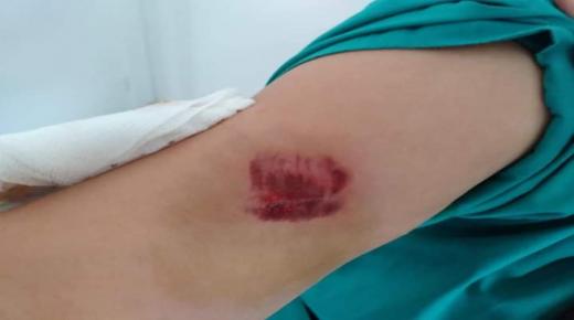 اعتداء على “قابلة” بالسب و الضرب من طرف سيدة بسبب “الكمامة” ضواحي طنجة