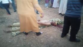 للاميمونة.. تعرض شاب للطعن بالسلاح الأبيض على مستوى الرأس