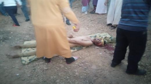 للاميمونة.. تعرض شاب للطعن بالسلاح الأبيض على مستوى الرأس