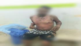 بائع متجول يضرم النار بجسده بسيدي بنور