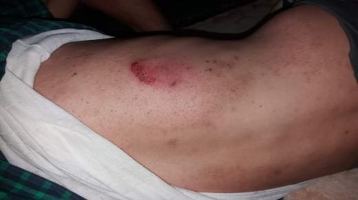 بيان استنكاري للمركز المغربي لحقوق الانسان حول الاعتداء على الحقوقي “قاسم الطش” بدائرة للاميمونة