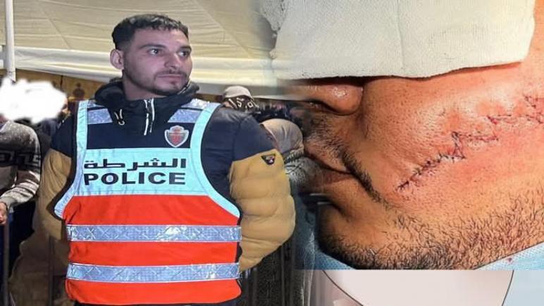 “وجه التضحية.. رجل الأمن زكرياء يُجسِّد معنى البطولة في القنيطرة”
