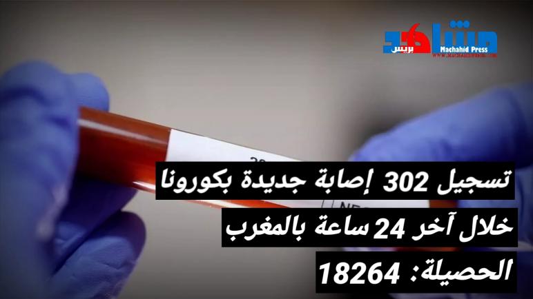 تسجيل 302 إصابة جديدة مؤكدة بكورونا خلال 24 ساعة في المغرب