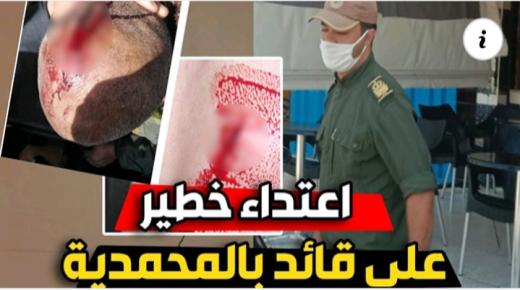 قايد قيادة سيدي موسي المجدوب بالمحمدية يطعن بسكين من صاحب مسكن عشوائي