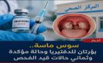الدفتيريا بسوس ماسة.. وزارة الصحة تؤكد بؤرتين عائليتين وتفعل إجراءات الاستجابة الوبائية