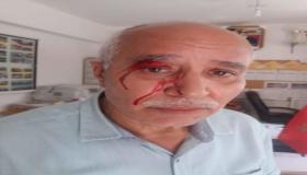 الاعتداء على الأساتذة متواصل.. أم تلميذ تتهجم وتعتدي على مدير مدرسة أبي هريرة.