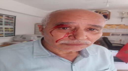 الاعتداء على الأساتذة متواصل.. أم تلميذ تتهجم وتعتدي على مدير مدرسة أبي هريرة.