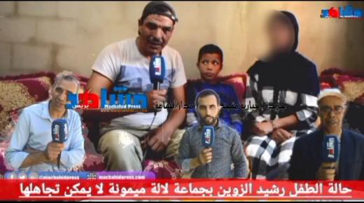 حالة الطفل رشيد الزوين بجماعة لالة ميمونة لا يمكن تجاهلها