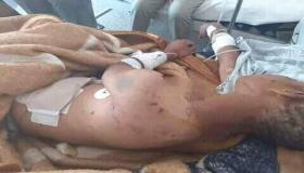 تعذيب طفل قاصر يرعى الغنم بمنطقة الحصية جماعة أبطيح.