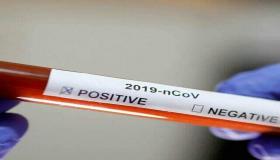 بعد توالي الارقام القياسية وزارة الصحة تعلن عن تراجع في عدد الإصابات