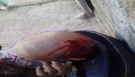 عائلة تتعرض للضرب المبرح باقليم سيدي افني وسط شكوك في الشواهد الطبية.